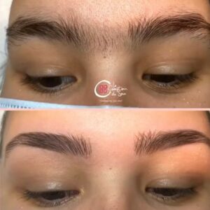 Restructuration Sourcils